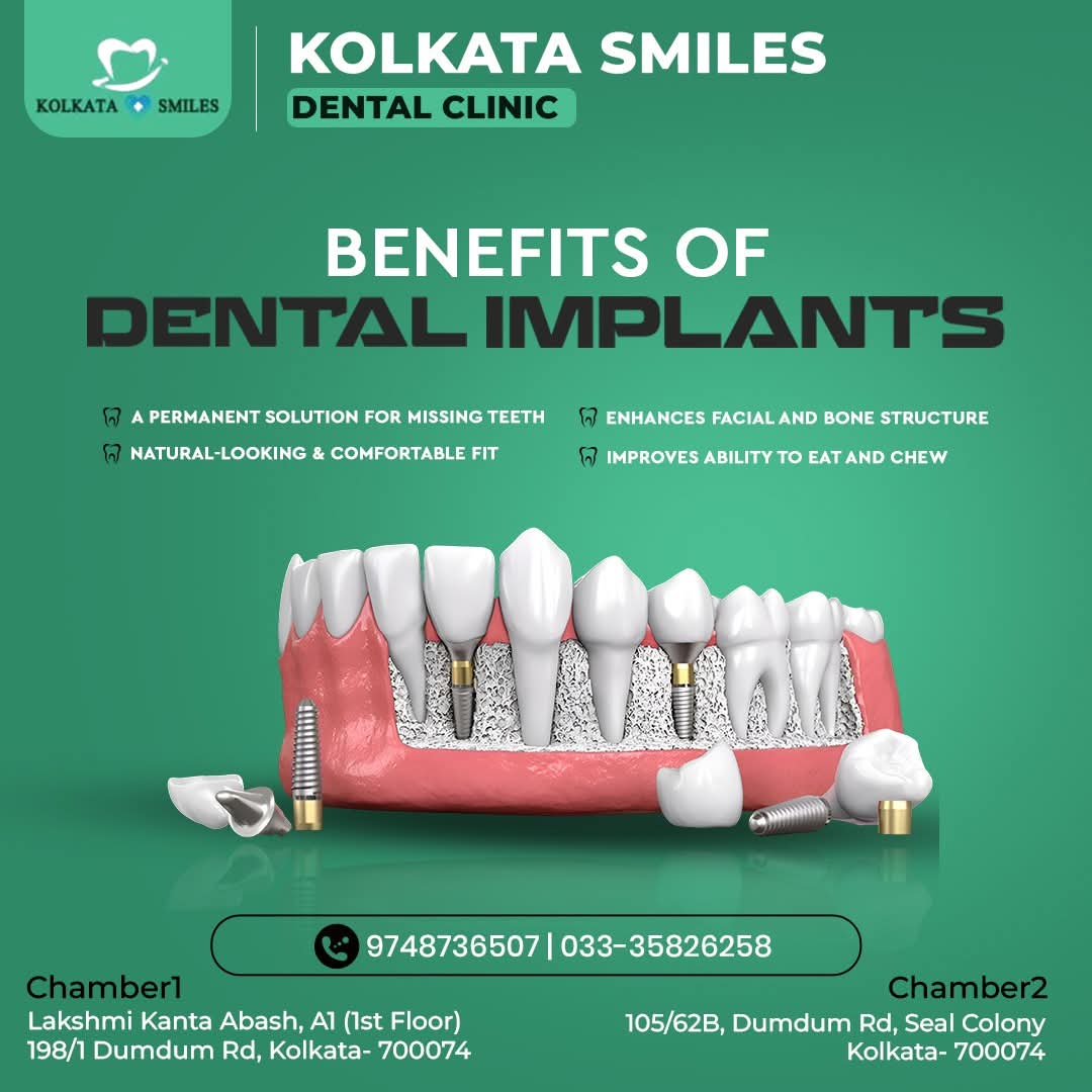 Dental implant with abutment and crown replacing a missing tooth