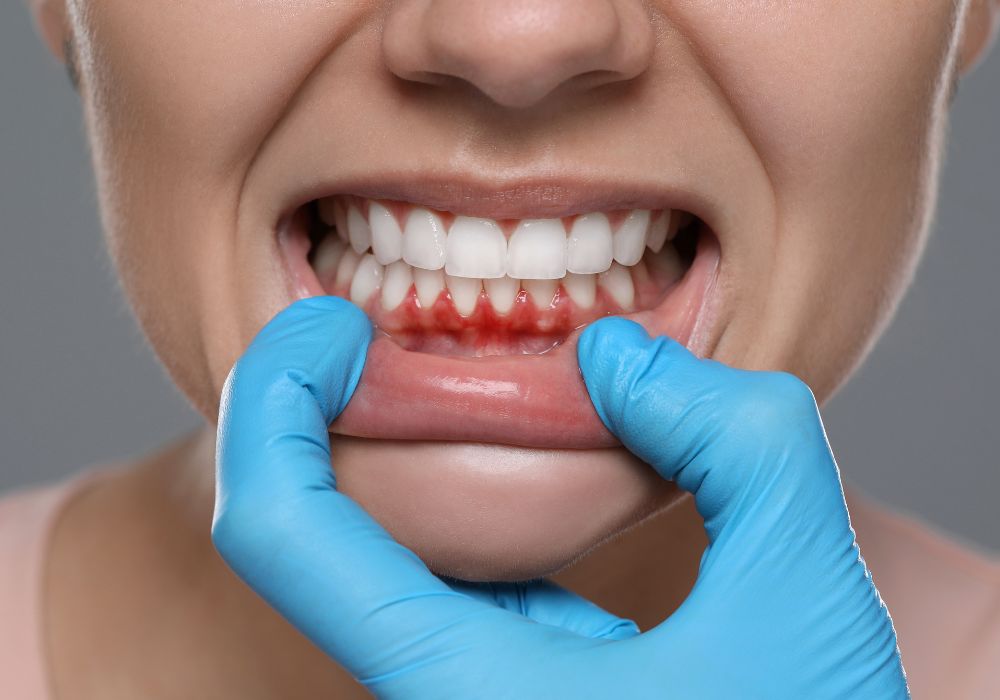 Gum Treatment at Kolkata Smiles Dental Clinic, Dum Dum, Kolkata