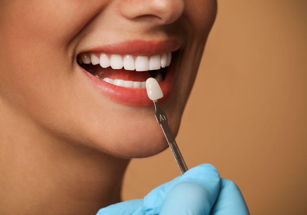 Dental Veneers at Kolkata Smiles Dental Clinic, Dum Dum, Kolkata